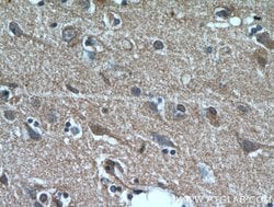 NHLRC1 Rabbit anti-Human, Polyclonal, Proteintech:Antibodies:Primary Antibodies