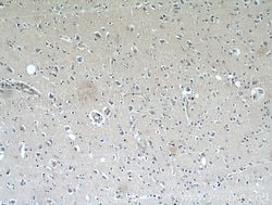 NHLRC1 Rabbit anti-Human, Polyclonal, Proteintech:Antibodies:Primary Antibodies