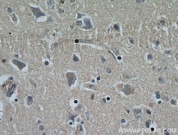 NHLRC1 Rabbit anti-Human, Polyclonal, Proteintech:Antibodies:Primary Antibodies