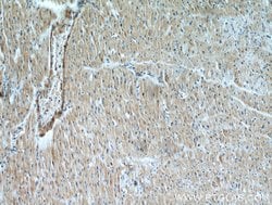 NHLRC1 Rabbit anti-Human, Polyclonal, Proteintech:Antibodies:Primary Antibodies