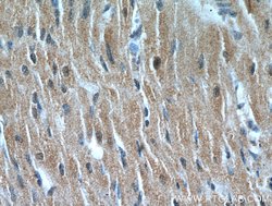 NHLRC1 Rabbit anti-Human, Polyclonal, Proteintech:Antibodies:Primary Antibodies