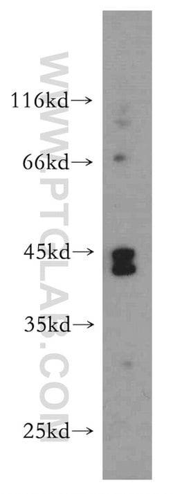 NHLRC1 Rabbit anti-Human, Polyclonal, Proteintech:Antibodies:Primary Antibodies