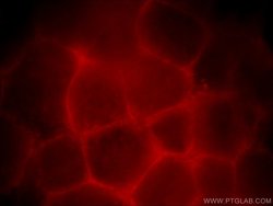 ZDHHC5 Rabbit anti-Human, Mouse, Rat, Polyclonal, Proteintech 150 &mu;L;