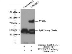 ZDHHC5 Rabbit anti-Human, Mouse, Rat, Polyclonal, Proteintech 150 &mu;L;