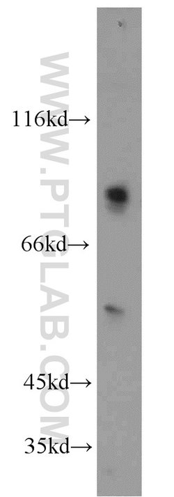 ZDHHC5 Rabbit anti-Human, Mouse, Rat, Polyclonal, Proteintech 150 &mu;L;