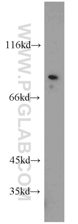ZDHHC5 Rabbit anti-Human, Mouse, Rat, Polyclonal, Proteintech 150 &mu;L;
