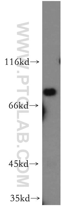 ZDHHC5 Rabbit anti-Human, Mouse, Rat, Polyclonal, Proteintech 150 &mu;L;