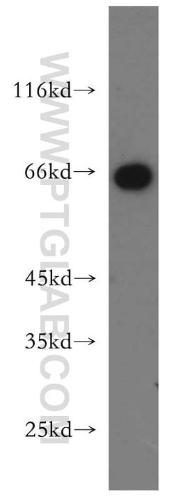 Sestrin 2 Rabbit anti-Human, Mouse, Polyclonal, Proteintech 20 &mu;L; Unconjugated:Antibodies,