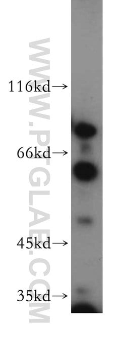Sestrin 2 Rabbit anti-Human, Mouse, Polyclonal, Proteintech 20 &mu;L; Unconjugated:Antibodies,