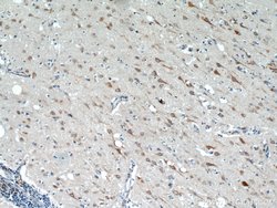 TMX4 Rabbit anti-Human, Mouse, Rat, Polyclonal, Proteintech 20 &mu;L; Unconjugated:Antibodies,