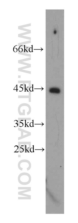 TMX4 Rabbit anti-Human, Mouse, Rat, Polyclonal, Proteintech 20 &mu;L; Unconjugated:Antibodies,