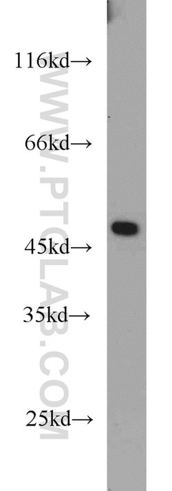 TMX4 Rabbit anti-Human, Mouse, Rat, Polyclonal, Proteintech 20 &mu;L; Unconjugated:Antibodies,