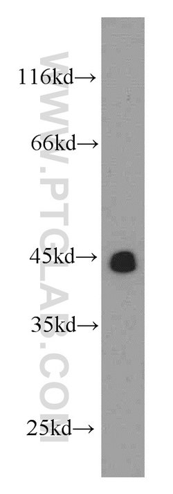 TMX4 Rabbit anti-Human, Mouse, Rat, Polyclonal, Proteintech 20 &mu;L; Unconjugated:Antibodies,