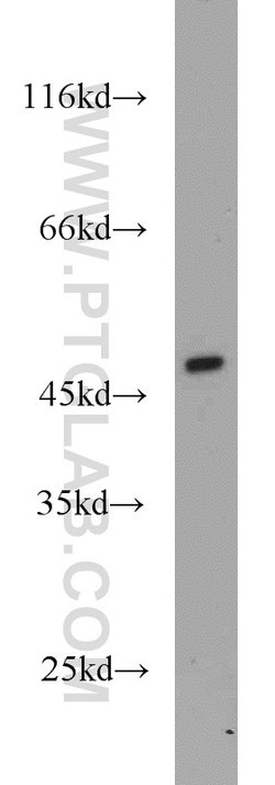 TMX4 Rabbit anti-Human, Mouse, Rat, Polyclonal, Proteintech 20 &mu;L; Unconjugated:Antibodies,