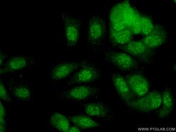 SNAI3 Rabbit anti-Human, Polyclonal, Proteintech:Antibodies:Primary Antibodies