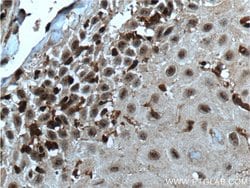 SNAI3 Rabbit anti-Human, Polyclonal, Proteintech:Antibodies:Primary Antibodies