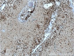 SNAI3 Rabbit anti-Human, Polyclonal, Proteintech:Antibodies:Primary Antibodies