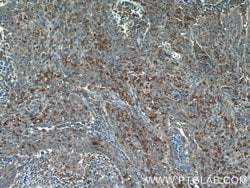 PLEKHO2 Rabbit anti-Human, Mouse, Polyclonal, Proteintech:Antibodies:Primary
