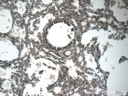 PLEKHO2 Rabbit anti-Human, Mouse, Polyclonal, Proteintech:Antibodies:Primary