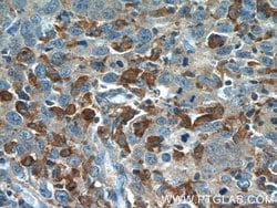 PLEKHO2 Rabbit anti-Human, Mouse, Polyclonal, Proteintech:Antibodies:Primary