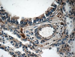 PLEKHO2 Rabbit anti-Human, Mouse, Polyclonal, Proteintech:Antibodies:Primary