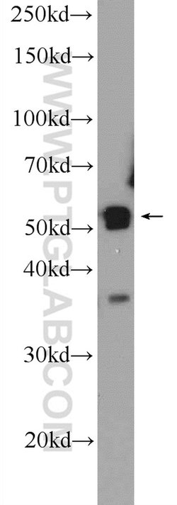 PLEKHO2 Rabbit anti-Human, Mouse, Polyclonal, Proteintech:Antibodies:Primary
