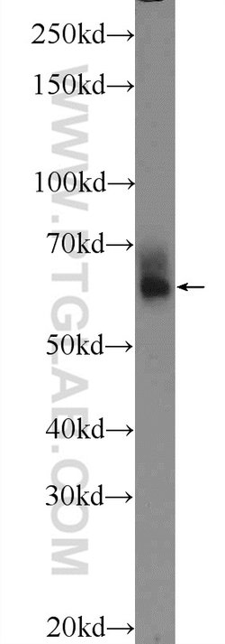 PLEKHO2 Rabbit anti-Human, Mouse, Polyclonal, Proteintech:Antibodies:Primary