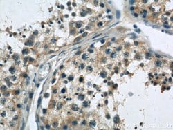 SASS6 Rabbit anti-Human, Polyclonal, Proteintech:Antibodies:Primary Antibodies