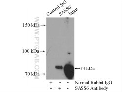 SASS6 Rabbit anti-Human, Polyclonal, Proteintech:Antibodies:Primary Antibodies