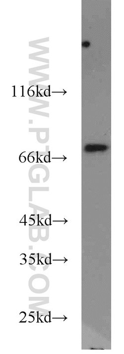 SASS6 Rabbit anti-Human, Polyclonal, Proteintech:Antibodies:Primary Antibodies