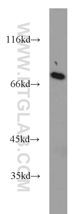 SASS6 Rabbit anti-Human, Polyclonal, Proteintech:Antibodies:Primary Antibodies