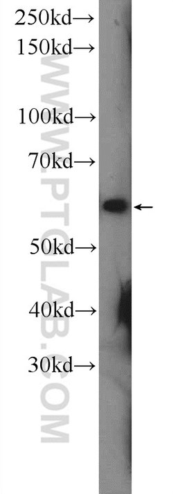 CHRNA7 Rabbit anti-Human, Mouse, Rat, Polyclonal, Proteintech 20 &mu;L;