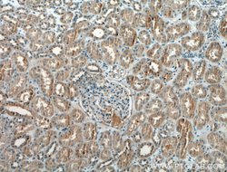 Pan-PAX Rabbit anti-Human, Mouse, Rat, Polyclonal, Proteintech:Antibodies:Primary