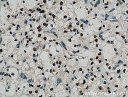 Pan-PAX Rabbit anti-Human, Mouse, Rat, Polyclonal, Proteintech:Antibodies:Primary