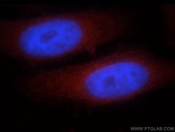 CCDC153 Rabbit anti-Human, Mouse, Rat, Polyclonal, Proteintech 150 &mu;L | Buy Online | Proteintech Group Inc | Fisher Scientific