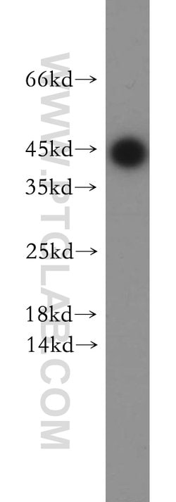 CCDC153 Rabbit anti-Human, Mouse, Rat, Polyclonal, Proteintech 150 &mu;L | Buy Online | Proteintech Group Inc | Fisher Scientific