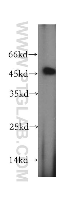 CCDC153 Rabbit anti-Human, Mouse, Rat, Polyclonal, Proteintech 150 &mu;L | Buy Online | Proteintech Group Inc | Fisher Scientific
