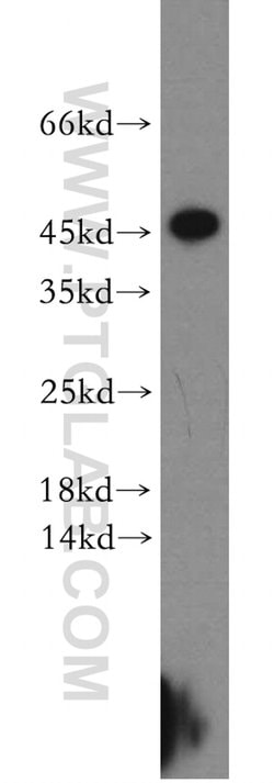 CCDC153 Rabbit anti-Human, Mouse, Rat, Polyclonal, Proteintech 150 &mu;L | Buy Online | Proteintech Group Inc | Fisher Scientific