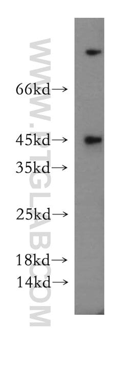 CCDC153 Rabbit anti-Human, Mouse, Rat, Polyclonal, Proteintech 150 &mu;L | Buy Online | Proteintech Group Inc | Fisher Scientific