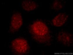 RNF168 Rabbit anti-Human, Polyclonal, Proteintech 150 &mu;L; Unconjugated:Antibodies,