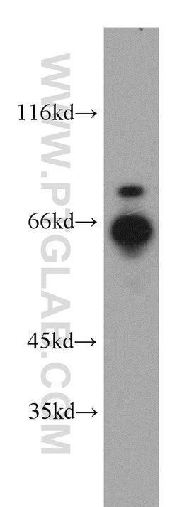 RNF168 Rabbit anti-Human, Polyclonal, Proteintech 150 &mu;L; Unconjugated:Antibodies,