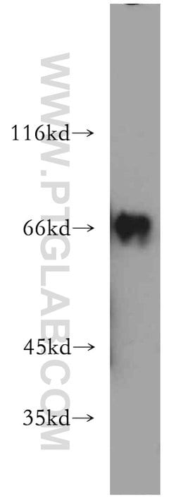 RNF168 Rabbit anti-Human, Polyclonal, Proteintech 150 &mu;L; Unconjugated:Antibodies,