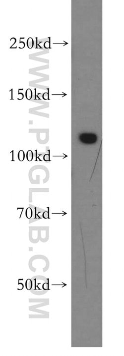 SGSM1 Rabbit anti-Human, Mouse, Polyclonal, Proteintech:Antibodies:Primary