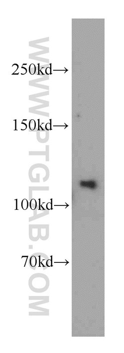 SGSM1 Rabbit anti-Human, Mouse, Polyclonal, Proteintech:Antibodies:Primary
