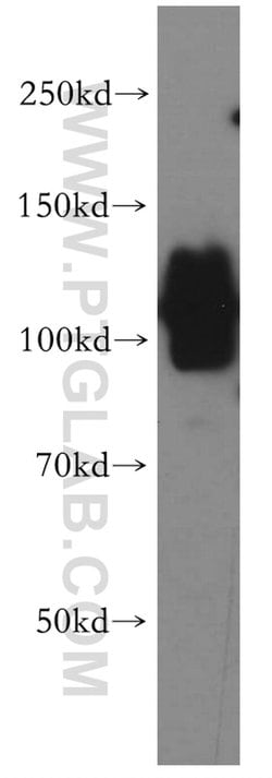 ERC2 Rabbit anti-Human, Mouse, Rat, Polyclonal, Proteintech 20 &mu;L; Unconjugated:Antibodies,