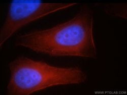 MYH10 Rabbit anti-Human, Mouse, Rat, Polyclonal, Proteintech 150 &mu;L;