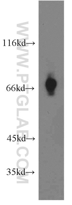 SLC5A8 Rabbit anti-Human, Mouse, Rat, Polyclonal, Proteintech 150 &mu;L;