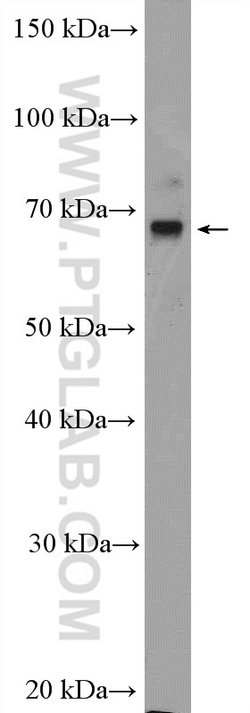 SLC5A8 Rabbit anti-Human, Mouse, Rat, Polyclonal, Proteintech 150 &mu;L;