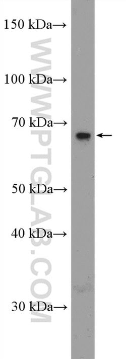 SLC5A8 Rabbit anti-Human, Mouse, Rat, Polyclonal, Proteintech 150 &mu;L;