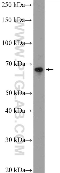 SLC5A8 Rabbit anti-Human, Mouse, Rat, Polyclonal, Proteintech 150 &mu;L;